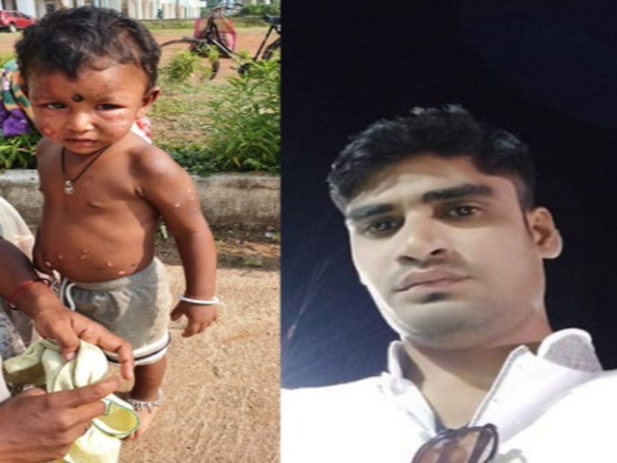 डेढ़ साल की बच्ची के शरीर को सिगरेट से दागने वाला सिपाही हुआ बर्खास्त