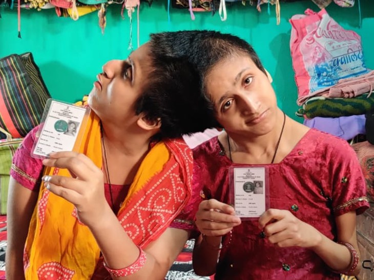 Meet such a unique voter of Bihar, who are one in spite of two, saba farah in patna, saba farah surgery, salman fan saba bihar election, patna voter | मिलिए बिहार की ऐसी यूनिक वोटर से जो दो होते हुए भी एक हैं, पहली बार अलग-अलग दिये वोट, एक-दूसरे से सिर से जुड़ी हैं